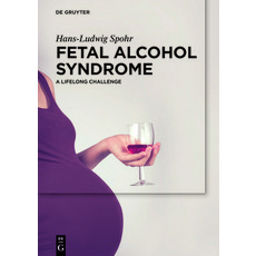 Fetal Alcohol Syndrome 精裝版, de Gruyter, 英文