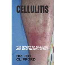 (英文圖書) Cellulitis: The Effect of Cellilitis and How to Deal with It 平裝版, Independently Published, 英文