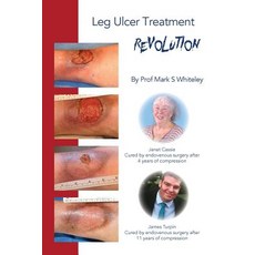 Leg Ulcer Treatment Revolution 平裝版, Whiteley Publishing Ltd, 英文