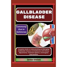 (英文圖書) Gallbladder Disease: Commonly Due to Gallstones: Complete Guide to Understandin... 平裝版, Independently Published, 英文