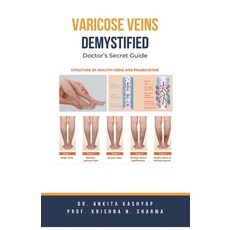 (英文圖書) Varicose Veins Demystified: Doctor's Secret Guide 平裝版, Virtued Press, 英文