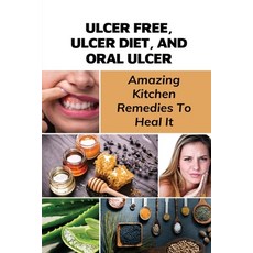 (英文圖書) Ulcer Free Ulcer Diet And Oral Ulcer: Amazing Kitchen Remedies To Heal It: How Do You Get R... 平裝版, Independently Published, 英文