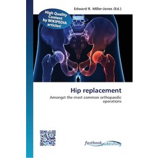 Hip replacement 平裝版, Fastbook Publishing, 英文