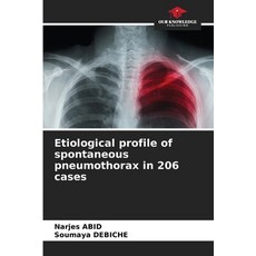(英文圖書) Etiological profile of spontaneous pneumothorax in 206 cases 平裝版, Our Knowledge Publishing, 英文