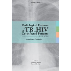 (英文圖書) Radiological features of TB in HIV Co-infected Patients. Case book 平裝版, Independently Published, 英文