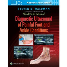 (英文圖書) Waldman's Atlas of Diagnostic Ultrasound of Painful Foot and Ankle Conditions 精裝版, LWW, 英文
