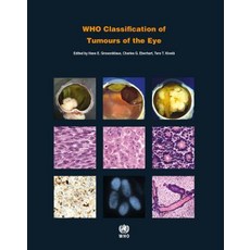 Who Classification of Tumours of the Eye 平裝版, World Health Organization, 英文
