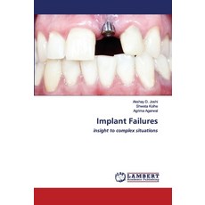 Implant Failures 平裝版, LAP Lambert Academic Publishing, 英文