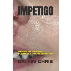 (英文圖書) Impetigo: Means of Freeing Yourself from Impetigo 平裝版, Independently Published, 英文