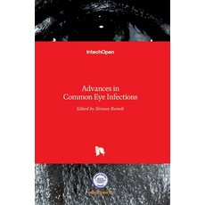 (英文圖書) Advances in Common Eye Infections 精裝版, Intechopen, 英文