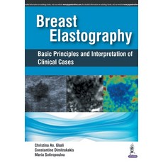 Breast Elastography: Basic Principles and Interpretation of Clinical Cases 平裝版, Jp Medical Ltd, 英文