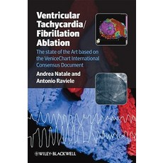 Ventricular Tachycardia / Fibrillation Ablation: The State of the Art Based on the Venicechart Interna..., Wiley-Blackwell