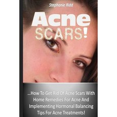 Acne Scars!: How to Get Rid of Acne Scars with Home Remedies for Acne and Implementing Hormonal Balanc..., Createspace Independent Publishing Platform