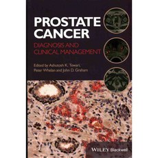 Prostate Cancer: Diagnosis and Clinical Management, Blackwell Pub