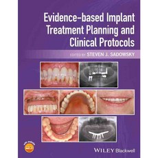 Evidence-based Implant Treatment Planning and Clinical Protocols, Blackwell Pub