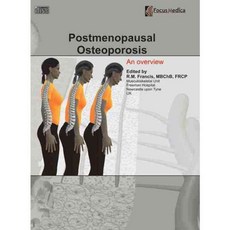 Postmenopausal Osteoporosis: An Overview, Focus Medica Pte Ltd