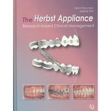 The Herbst Appliance: Research-based Clinical Management, Quintessence Pub Co