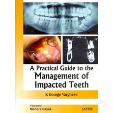 A Practical Guide to the Management of Impacted Teeth, Jaypee Brothers Medical Pub