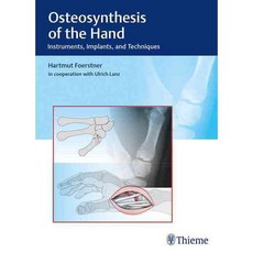 Osteosynthesis of the Hand: Instruments Implants and Techniques, Thieme Medical Pub