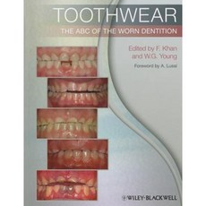 Toothwear: The ABC of the Worn Dentition 平裝版, Wiley-Blackwell