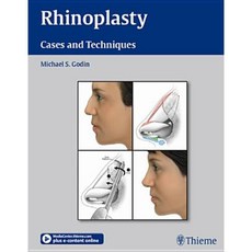 Rhinoplasty - Cases and Techniques: Cases and Techniques Hardcover, Thieme Medical Publishers