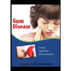 Gum Disease Paperback, SC Active Business Development Srl