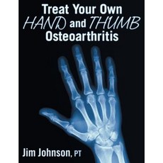 Treat Your Own Hand and Thumb Osteoarthritis Paperback, Dog Ear Publishing