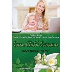 Cure Child Eczema: Natural Methods That Work Paperback, Createspace Independent Publishing Platform