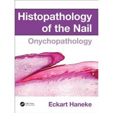 Histopathology of the Nail: Onychopathology Hardcover, CRC Press