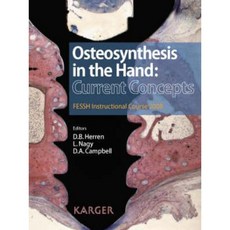Osteosynthesis in the Hand: Current Concepts Hardcover, S. Karger AG (Switzerland)