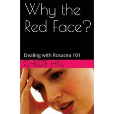 為什麼臉紅？, 聖艾夫斯媒體