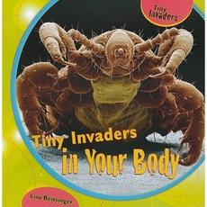 Tiny Invaders in Your Body Paperback, PowerKids Press