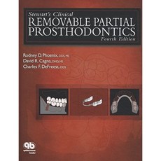 Stewart's Clinical Removable Partial Prosthodontics Hardcover, Quintessence Publishing (IL)