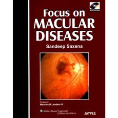 Focus on Macular Diseases Hardcover, Jp Medical Ltd