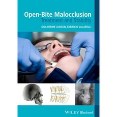 Open-Bite Malocclusion: Treatment and Stability Paperback, Wiley-Blackwell