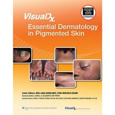 Visualdx: Essential Dermatology in Pigmented Skin Hardcover, LWW