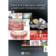 Clinical and Laboratory Manual of Implant Overdentures 精裝版, Wiley-Blackwell