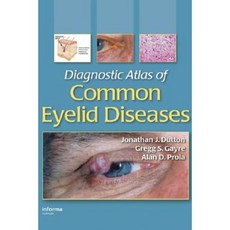 Diagnostic Atlas of Common Eyelid Diseases Hardcover, CRC Press