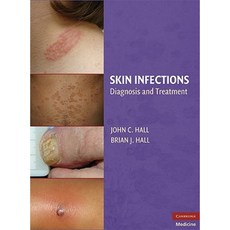 Skin Infections: Diagnosis and Treatment Hardcover, Cambridge University Press