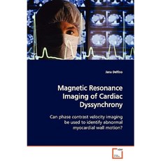 Magnetic Resonance Imaging of Cardiac Dyssynchrony Paperback, VDM Verlag