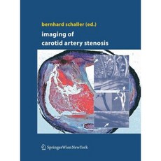 頸動脈狹窄的影像平裝本, 施普林格