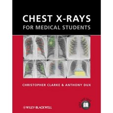 Chest X-Rays for Medical Students Paperback, Wiley-Blackwell
