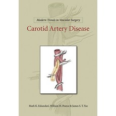Carotid Artery Disease Hardcover, People's Medical Publishing House