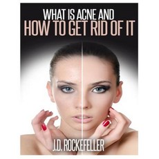 What Is Acne and How to Get Rid of It Paperback, Createspace Independent Publishing Platform