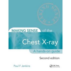 Making Sense of the Chest X-Ray Second Edition: A Hands-On Guide Paperback, CRC Press