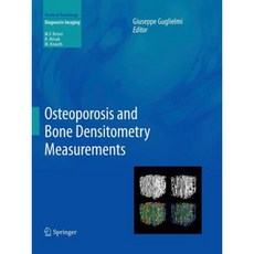 Osteoporosis and Bone Densitometry Measurements Paperback, Springer