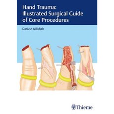 Hand Trauma: Illustrated Surgical Guide of Core Procedures Hardcover, Thieme Medical Publishers