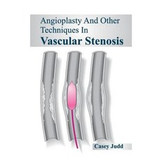 Angioplasty and Other Techniques in Vascular Stenosis Hardcover, Foster Academics