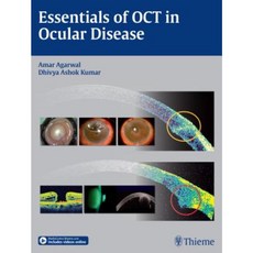 Essentials of Oct in Ocular Disease Hardcover, Thieme Medical Publishers