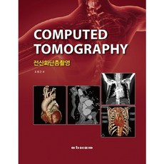 電腦斷層掃描, Academia, 趙平坤 等著